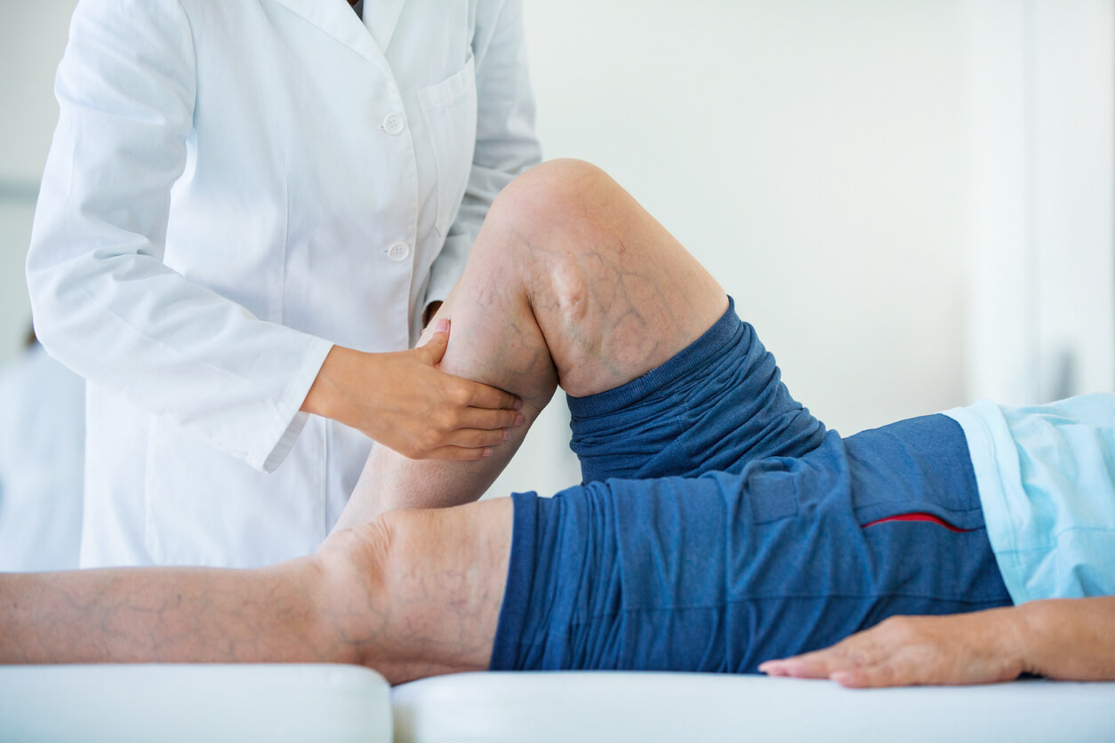 Closeup side view of unrecognizable female doctor massaging legs and calves of a senior female patient with visible varicose veins.